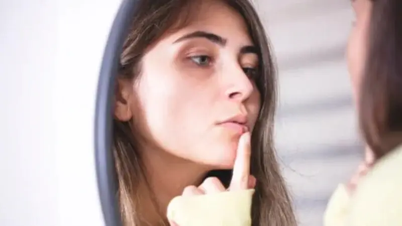Home Remedies Cold Sores